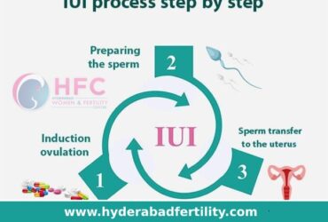 IUI Treatment in Hyderabad