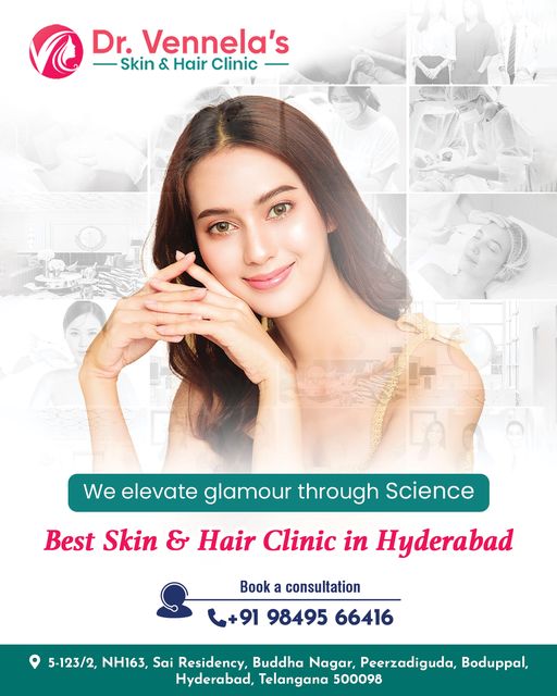 Best Skin Specialist in Peerzadiguda | Hair Loss Treatment in Peerzadiguda