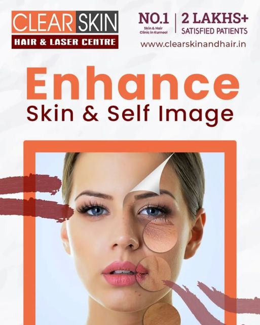 skin allergy doctor in kurnool