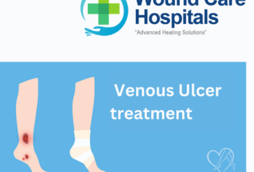 Best Venous Ulcer treatment in Hyderabad | Kukatpally | KPHB – WCH