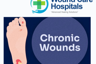 Chronic Wounds Treatment in hyderabad | Kukatpally | KPHB – WCH