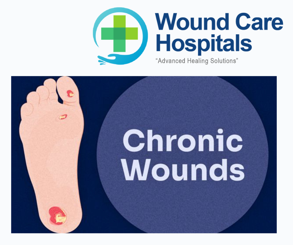 Chronic Wounds Treatment in hyderabad | Kukatpally | KPHB – WCH