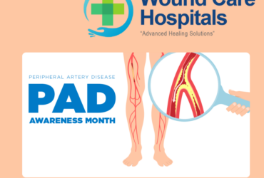 Peripheral Arterial Disease Treatment in Hyderabad | kukatpally – WCH