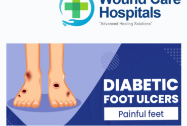 Best Diabetic Foot Ulcer Treatment in Hyderabad | Kukatpally | KPHB – WCH