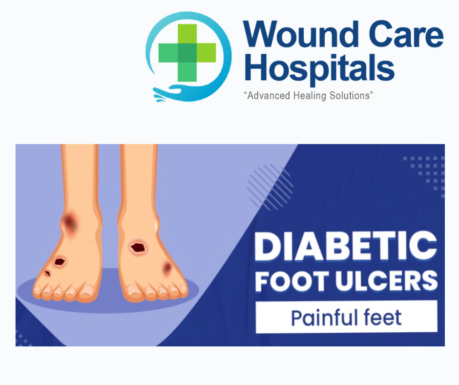 Best Diabetic Foot Ulcer Treatment in Hyderabad | Kukatpally | KPHB – WCH