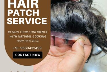 Hair Patch in Delhi – Natural Look Guaranteed