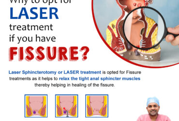 laser fistula treatment in hyderabad | kukatpally – Treatment Range Hospital