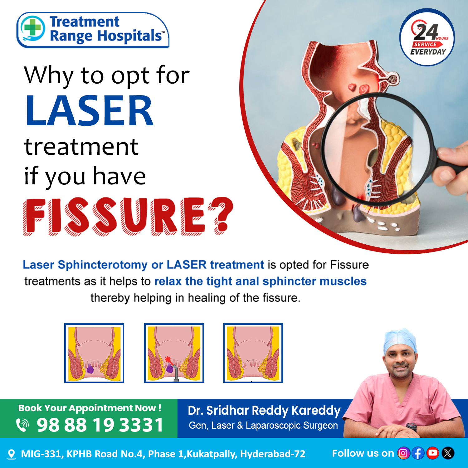 laser fistula treatment in hyderabad | kukatpally – Treatment Range Hospital