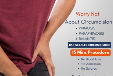 circumcision hospital in hyderabad | Bangalore  – CircumCure