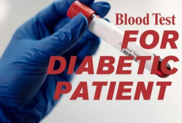 Blood Test in Gomti Nagar Lucknow