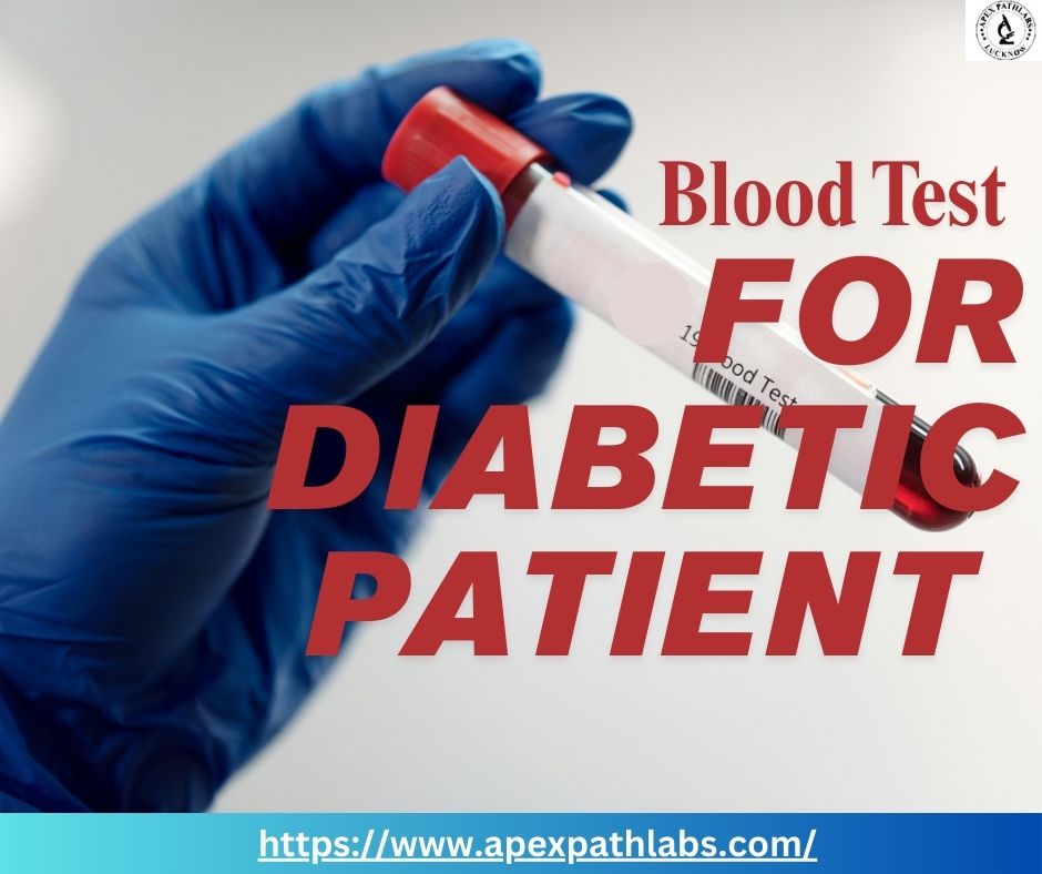 Blood Test in Gomti Nagar Lucknow